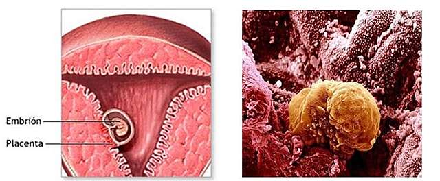 Día 6: Implantación