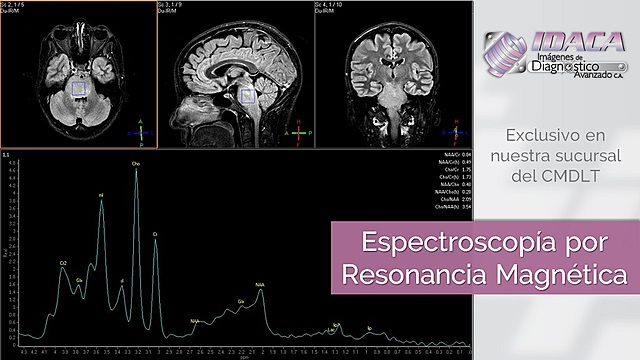 “APPLICATION OF FOURIER TRANSFORM SPECTROSCOPY TO MAGNETIC RESONANCE”