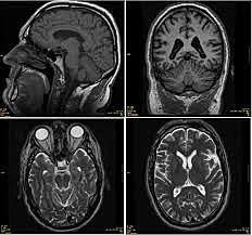 PRIMERAS IMÁGENES DE LA CABEZA