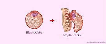 IMPLANTACIÓN DEL BLASTOCISTO