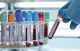 Barnett diseña los "valores normales"