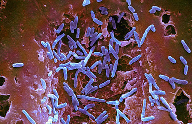 Descubren Salmonella.