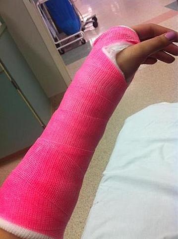 When I Broke My Arm