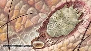 Jannier, 1994; Ramos-e-Silva, 1998