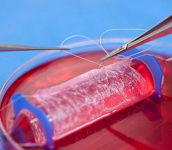 INGENIERÍA DE TEJIDOS