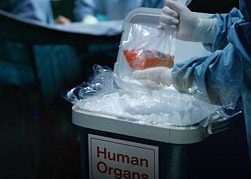 PRIMER TRASPLANTE DE UN ÓRGANO COMPLETO CULTIVADO