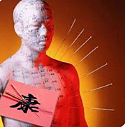 ACUPUNTURA CHINA, MEDICINA ALTERNATIVA