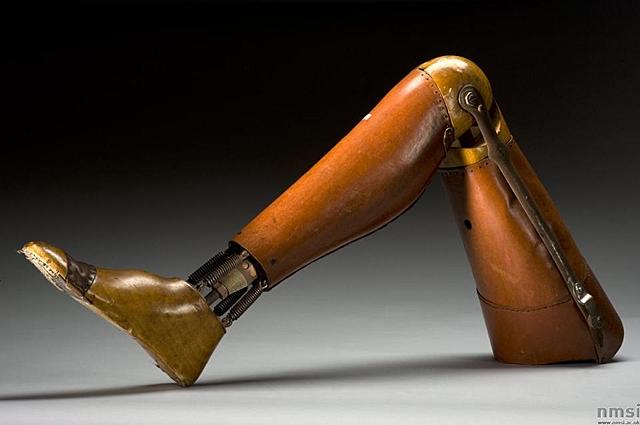 Inicios de la Ortopedia