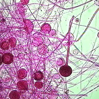 Timeline: Historia de fitopatología Wxx