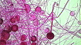 Timeline: Historia de fitopatología Wxx