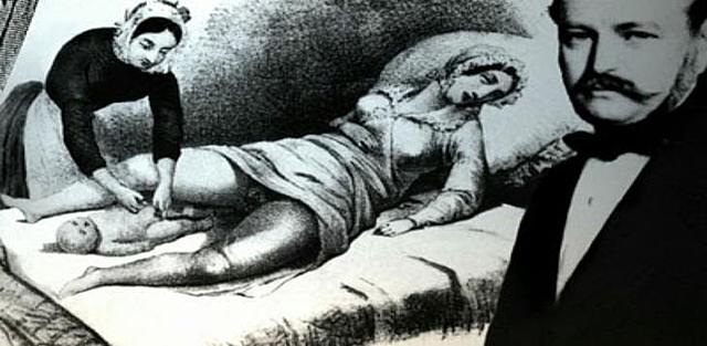 Epidemiología de la fiebre puerperal