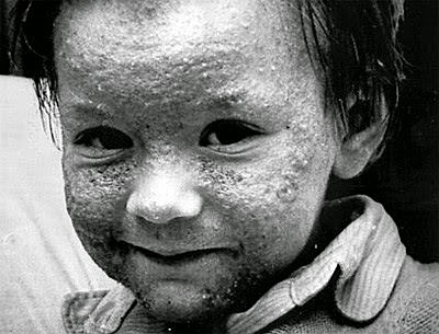 Tragedia de Seveso - Italia