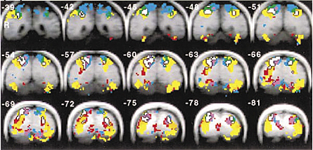 John W. Belliveau, Peter Bandettini y Seiji Ogawa publican de forma independiente sus estudios sobre la respuesta cerebral a la estimulación sensorial para los que utilizan imágenes obtenidas por resonancia magnética funcio