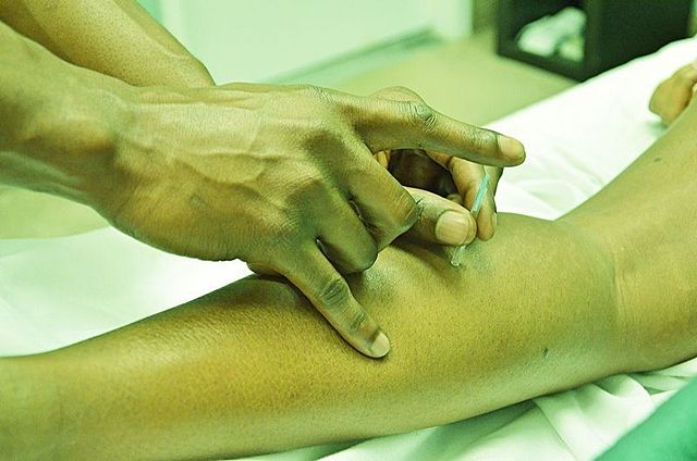 Terapias Alternativas