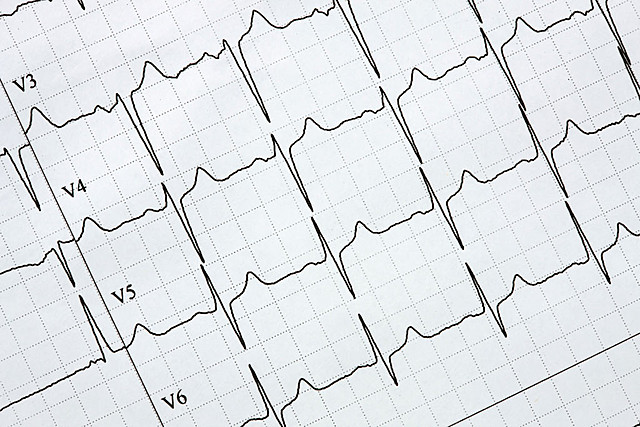 Electrocardiografía