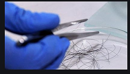 Hair now used in forensics