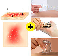 Medicina tradicional china