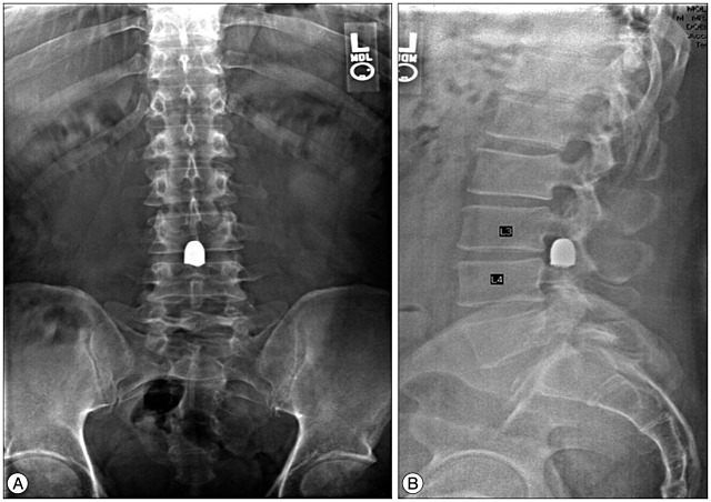 Retreat from the Red Army