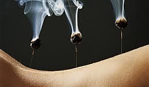 ACUPUNTURA Y MOXIBUSTIÓN