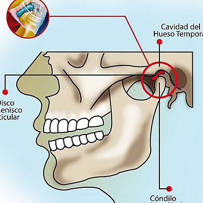 Timeline: Historia de los trastornos temporomandibulares