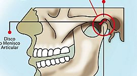 Timeline: Historia de los trastornos temporomandibulares