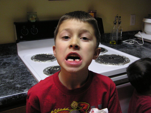 Lost first tooth.