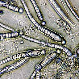 descubrimiento de la bacteria. Anton Van Leeuwenhoek observo agua estancada en un charco pequeñas especies a las que llamaria Animálculos
