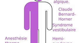 Timeline: Caso clínico Síndrome de Wallenberg