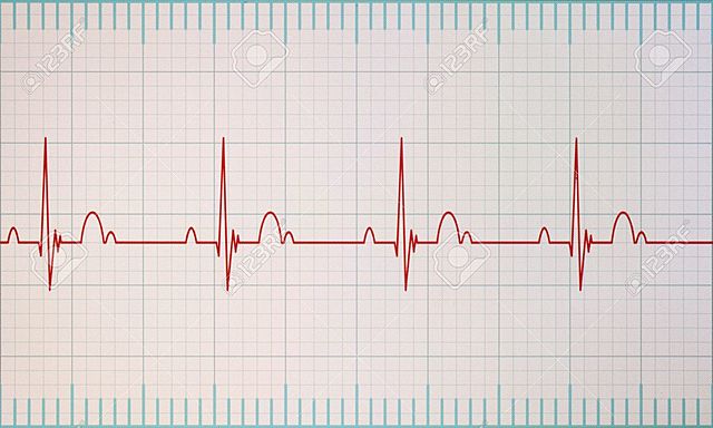 Sistema cardivascular