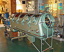 The Iron Lung Is Created Saving Polio Victims Lives