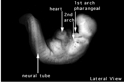 Semana 4: dia 26 al 30