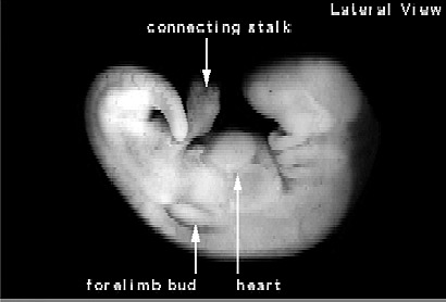 Semana 5: del 28 al 32