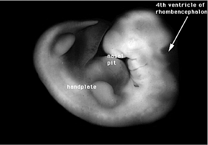 Semana 5: del 35 al 38
