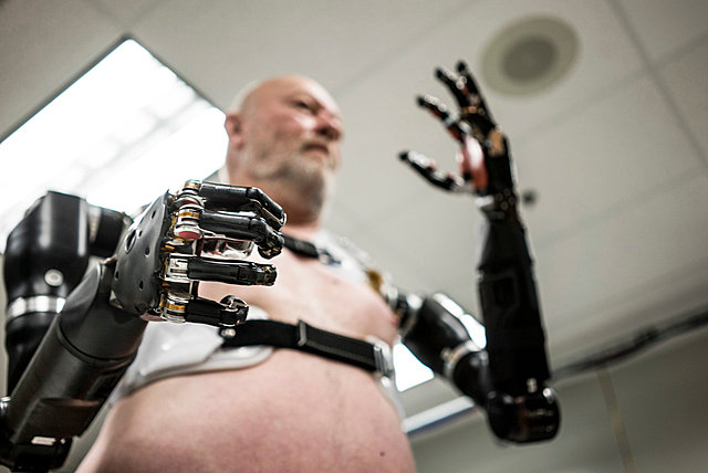 The First Amputee Controlled a Robotic Limb With Neural Implants