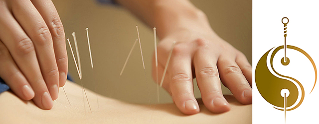 100 A.C ACUPUNTURA CHINA, MEDICINA ALTERNATIVA