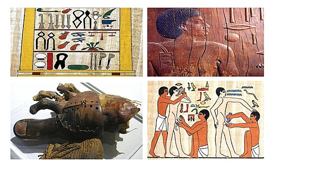 Las prácticas médicas de Antiguo Egipto que aún se utilizan