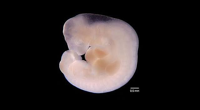 Segunda Semana; Días 8-10