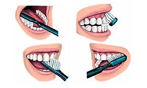 Técnica de cepillado