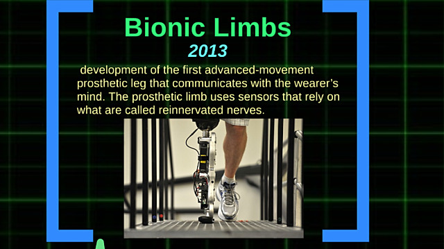Bionic Limbs