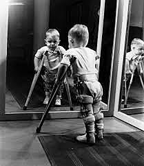 First Polio Patient Saved