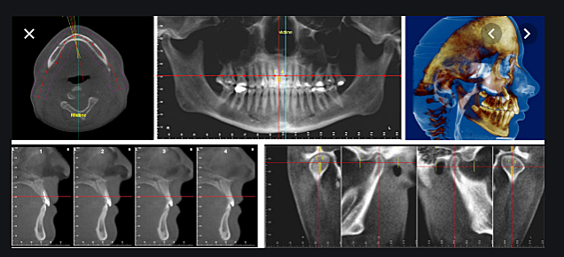 Oral Maxillofacial Radiology