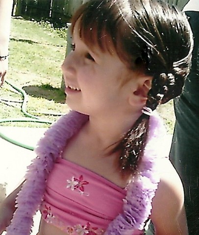 the time i got stiches on my eye.