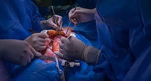 First heart transplant performed by South African heart surgeon Dr. Christiaan Barnard