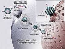 Gene therapy