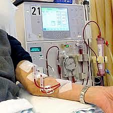 The First dialysis machine