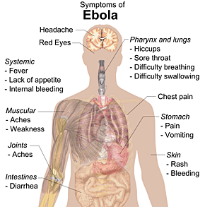 Ebola