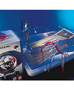 Dr. Kenneth Matsumura's bio-artificial liver.