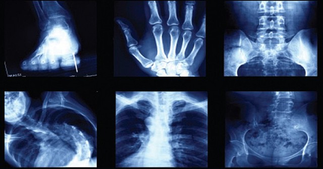 the x- ray