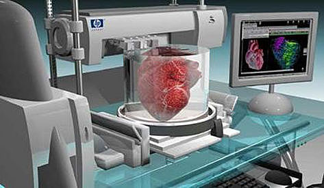 Artificial Organs