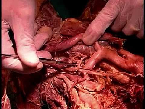 Anatomy and Dissection